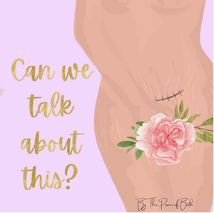 birth trauma image of woman with c section scar and flower. can we talk about this podcast image